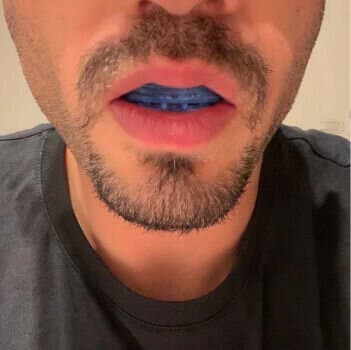 Frank
